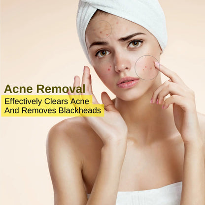 24K Gold Peel-Off Face Mask | Ammuri