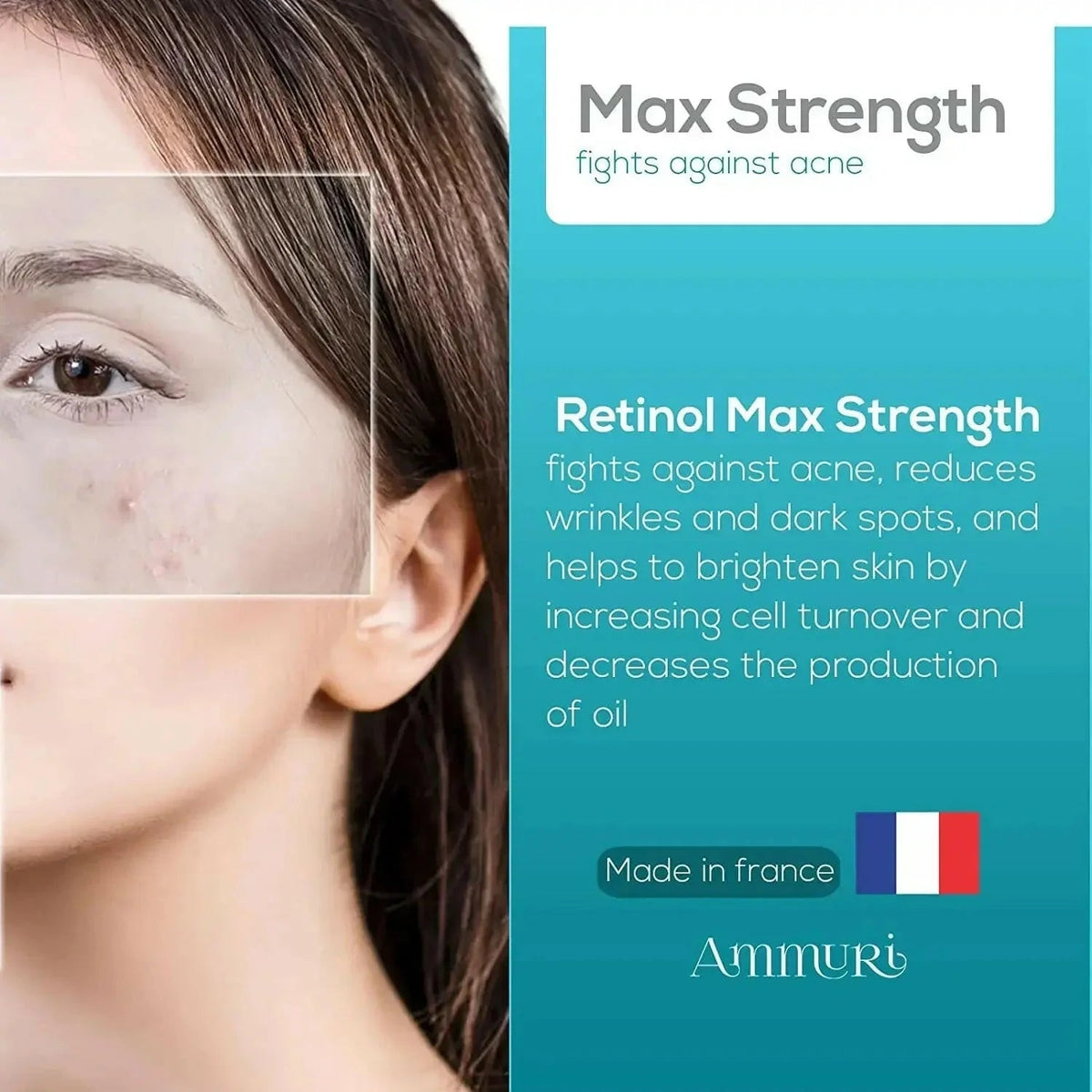 Retinol MAX 5% High Strength Anti-Ageing Serum (30ml) | Ammuri