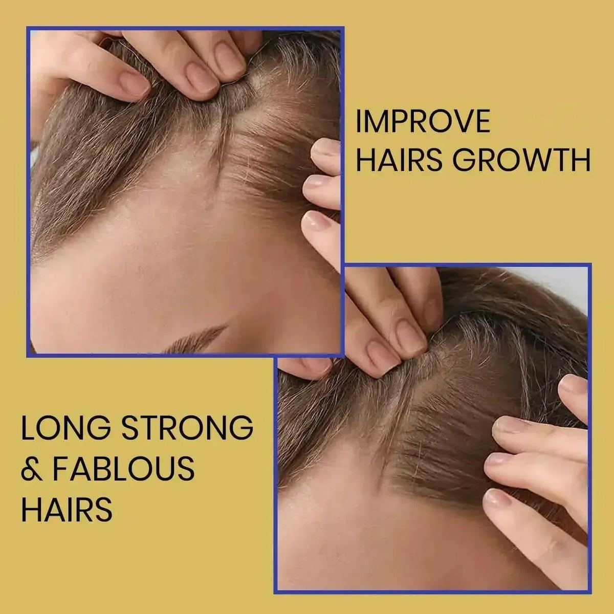 Biotin Shampoo for Hair Thinning & Thicker-Looking Hair (473ml) | Ammuri Beauty