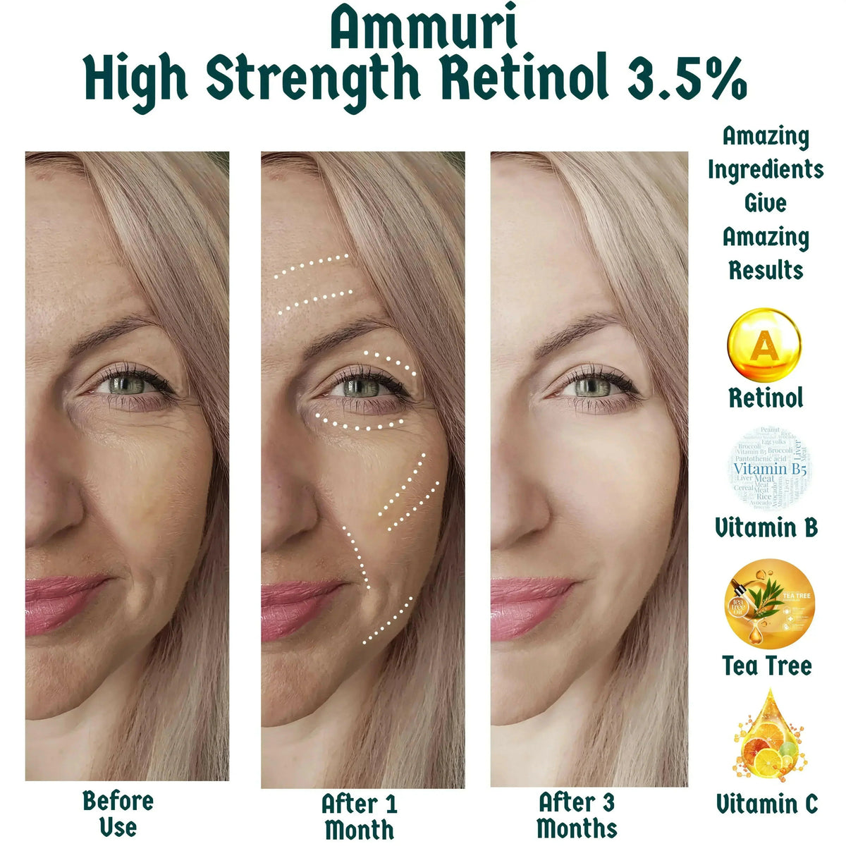 Retinol 3.5% Face Serum for Smoother-Looking Skin | Ammuri Beauty