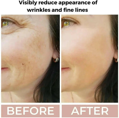 Retinol 3.5% Face Serum for Smoother-Looking Skin | Ammuri Beauty