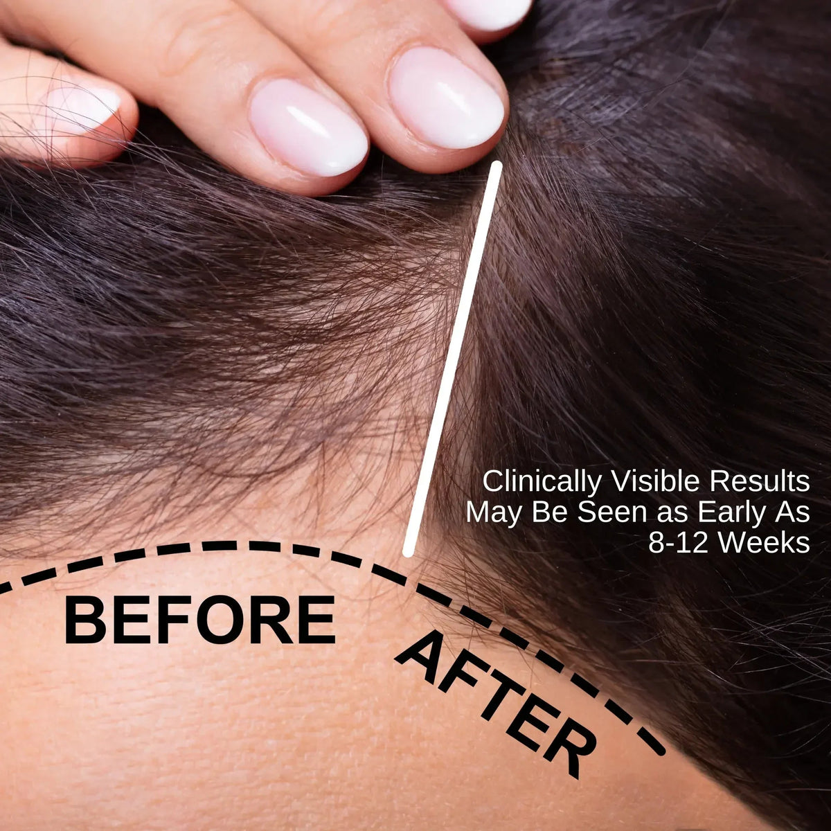 Botanical Hair & Scalp Oil for Thinning-Looking Hair 50ml | Ammuri