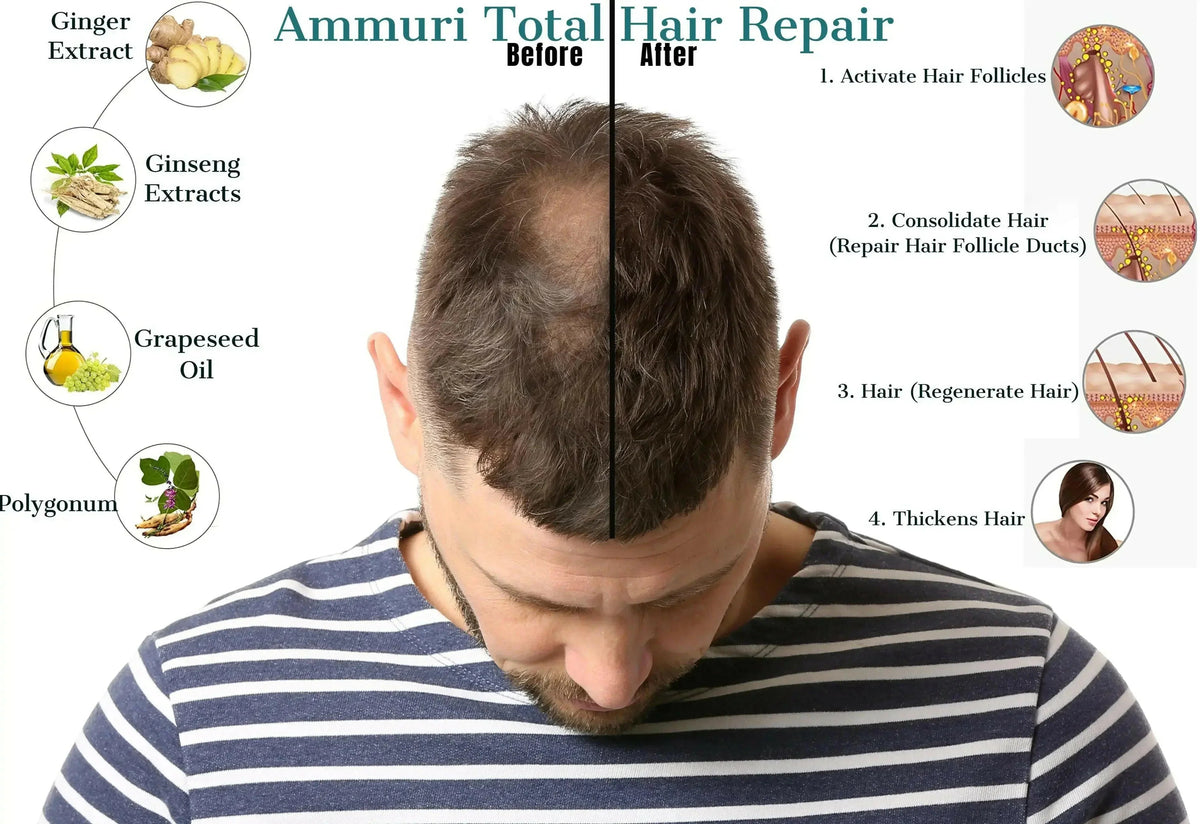 Botanical Hair & Scalp Oil for Thinning-Looking Hair 50ml | Ammuri