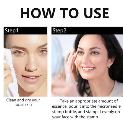 Saranova Beauty Micro Infusion System for Face — Moisturizing Serum & Stamp (1-Month Supply)